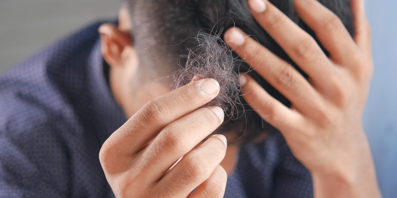 What Causes Hair Loss in Men and What Can You Do About It?